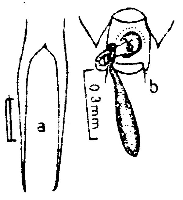 Espce Pontellina plumata - Planche 6 de figures morphologiques