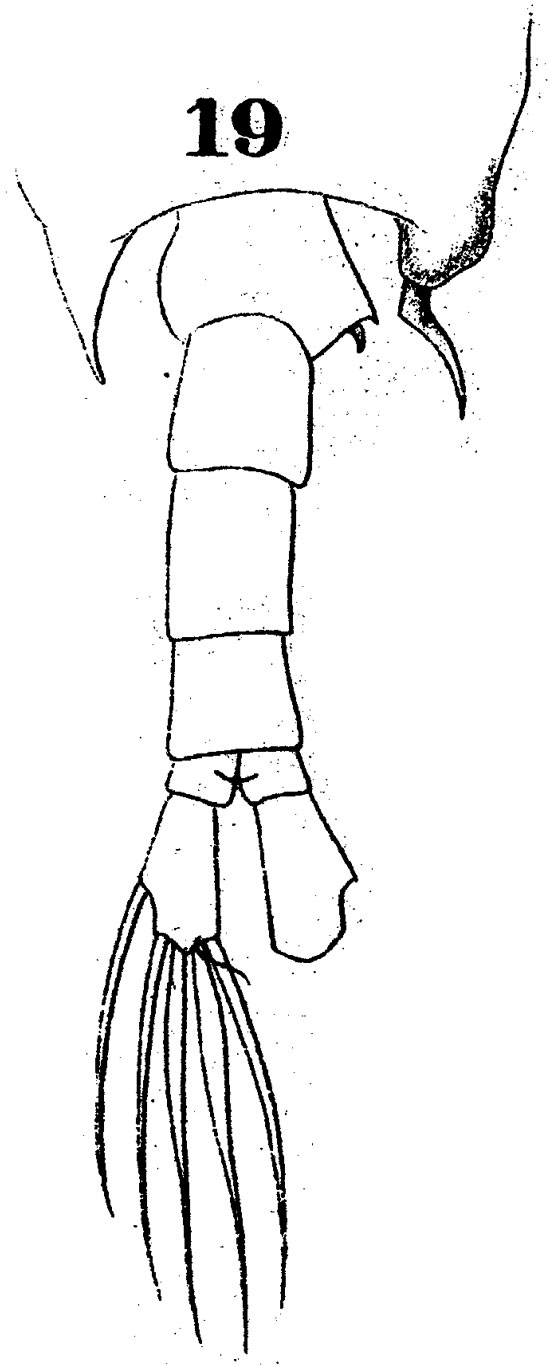 Espce Labidocera acuta - Planche 10 de figures morphologiques