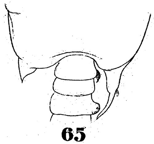Espèce Pontellopsis strenua - Planche 5 de figures morphologiques