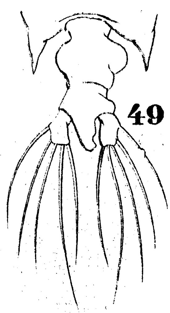 Espèce Pontellopsis perspicax - Planche 2 de figures morphologiques