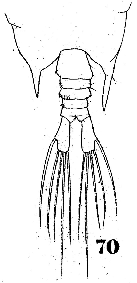 Espèce Pontellopsis brevis - Planche 4 de figures morphologiques