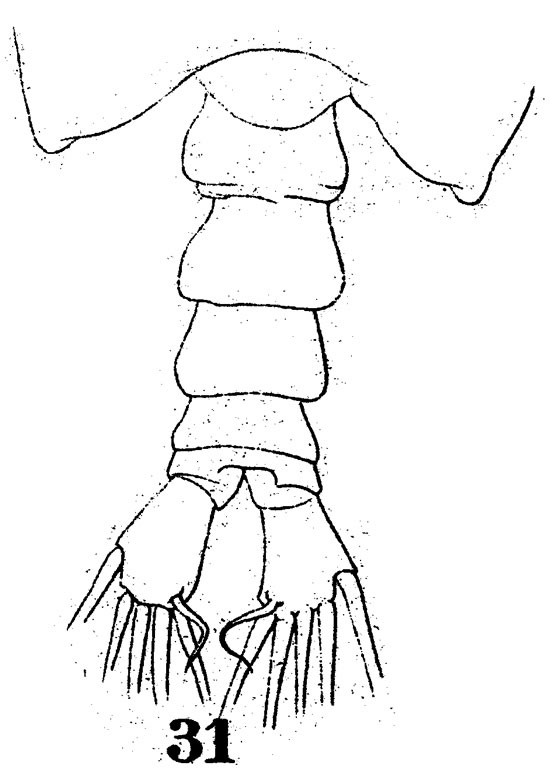 Espce Labidocera detruncata - Planche 7 de figures morphologiques