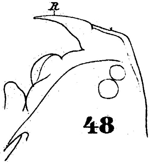 Espèce Anomalocera patersoni - Planche 13 de figures morphologiques