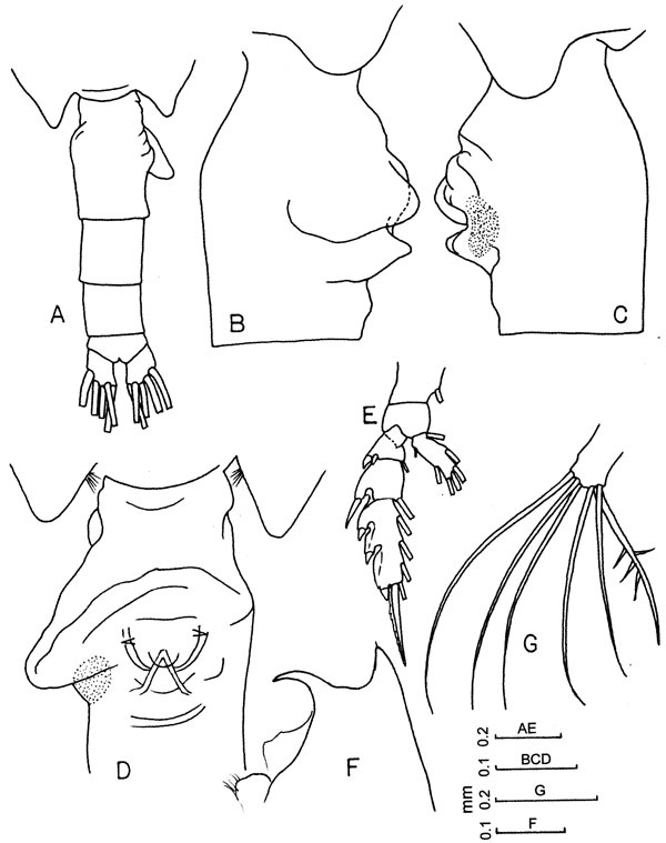 Espèce Euchaeta concinna - Planche 10 de figures morphologiques