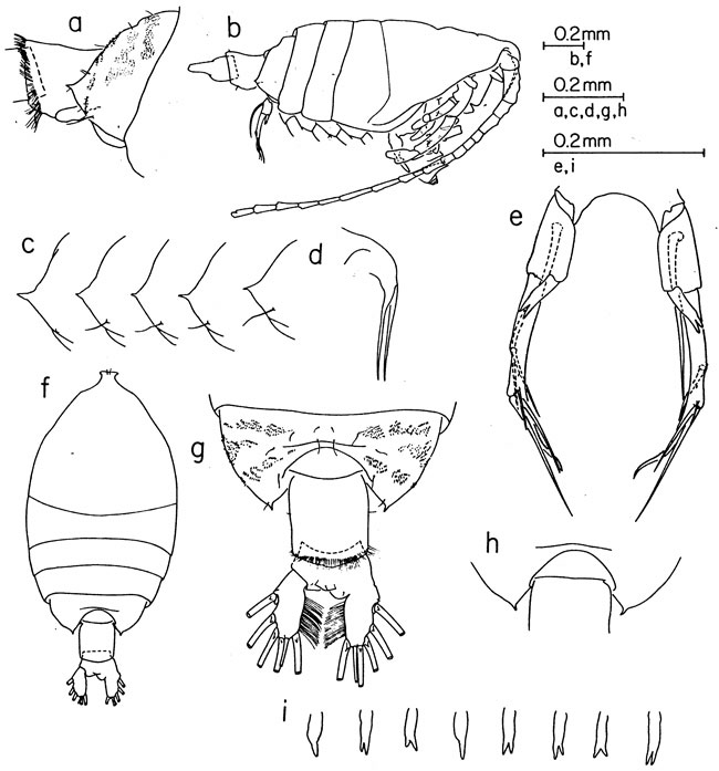 Espce Pontellina platychela - Planche 1 de figures morphologiques