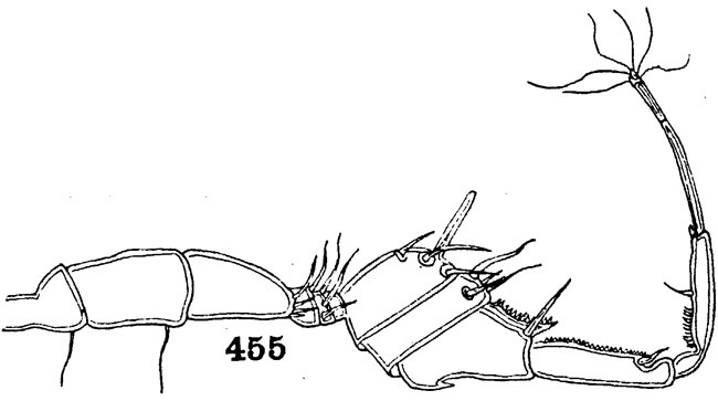 Espce Pontellopsis bitumida - Planche 4 de figures morphologiques