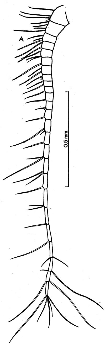 Espce Acrocalanus andersoni - Planche 4 de figures morphologiques