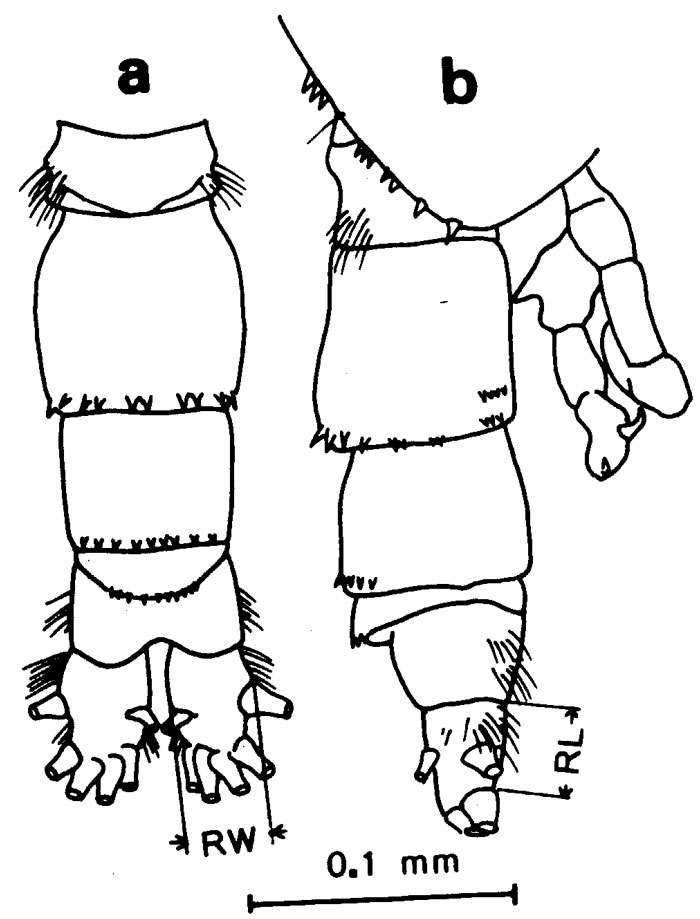 Espce Acartia (Acanthacartia) plumosa - Planche 3 de figures morphologiques