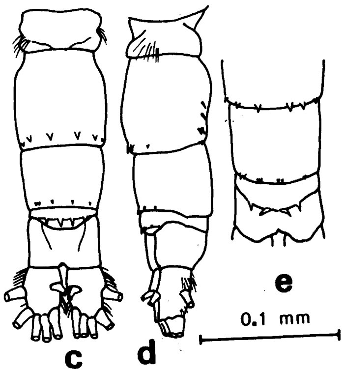 Espèce Acartia (Acanthacartia) sinjiensis - Planche 6 de figures morphologiques