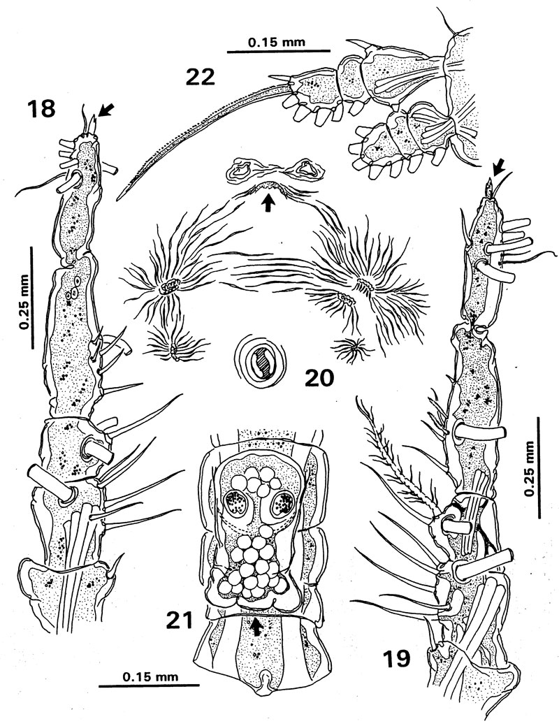 Espce Monstrilla globosa - Planche 2 de figures morphologiques