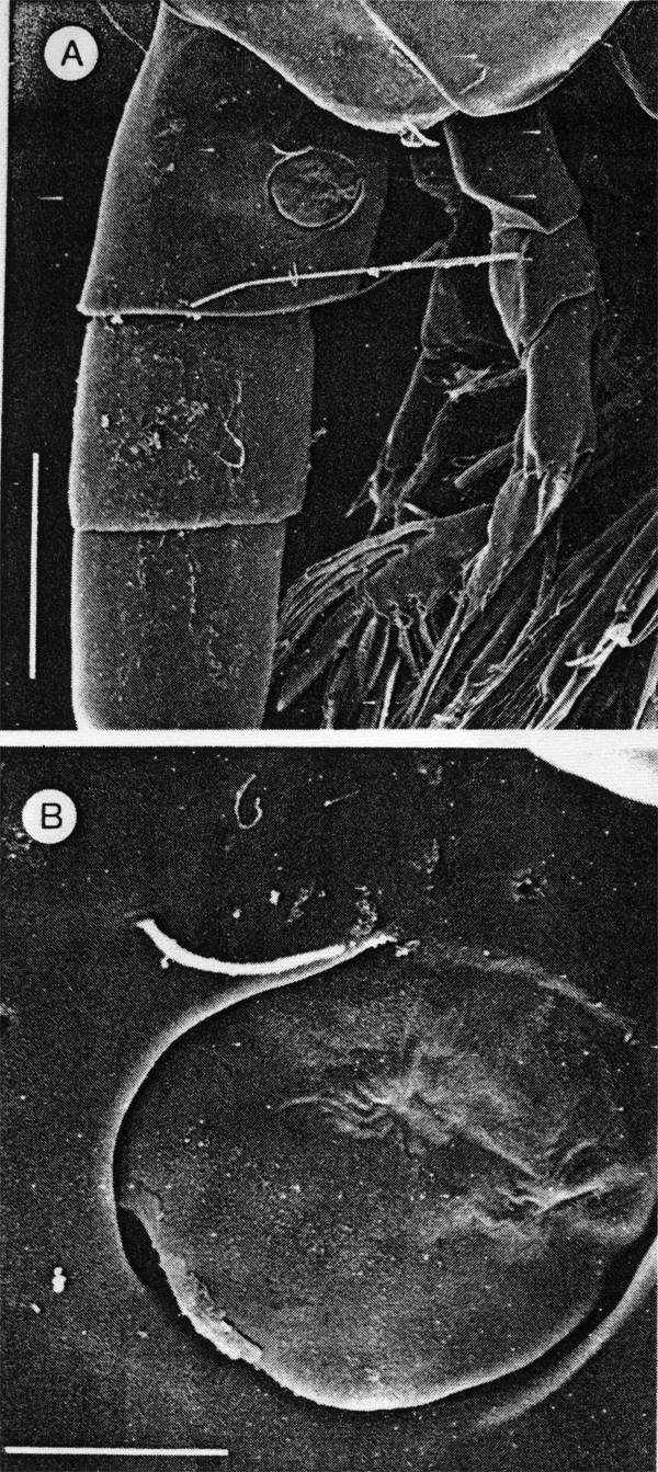 Espce Exumella mediterranea - Planche 5 de figures morphologiques
