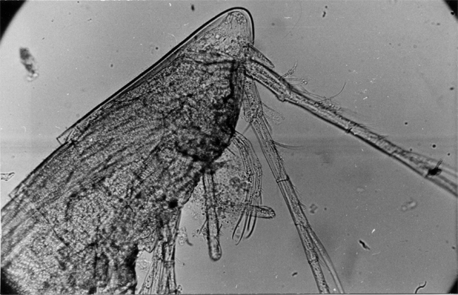 Espèce Macrosetella gracilis - Planche 5 de figures morphologiques