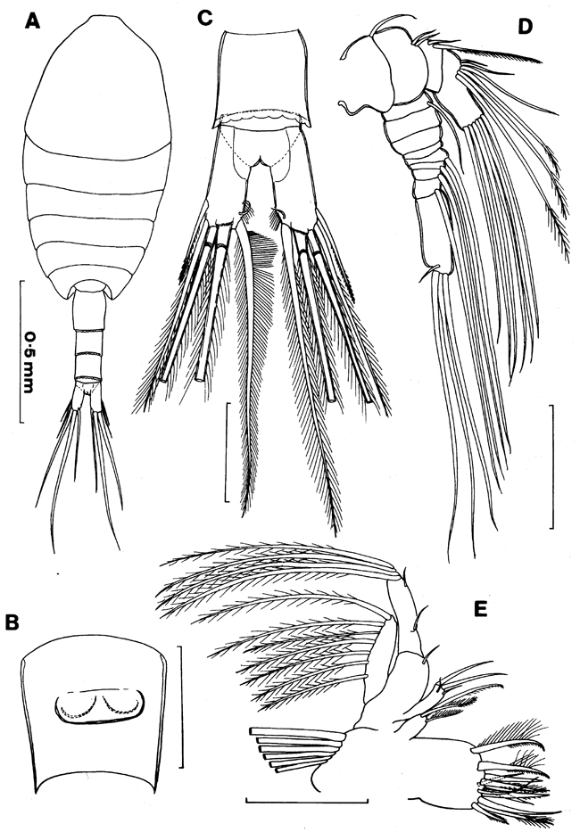 Espèce Iboyella cubensis - Planche 1 de figures morphologiques