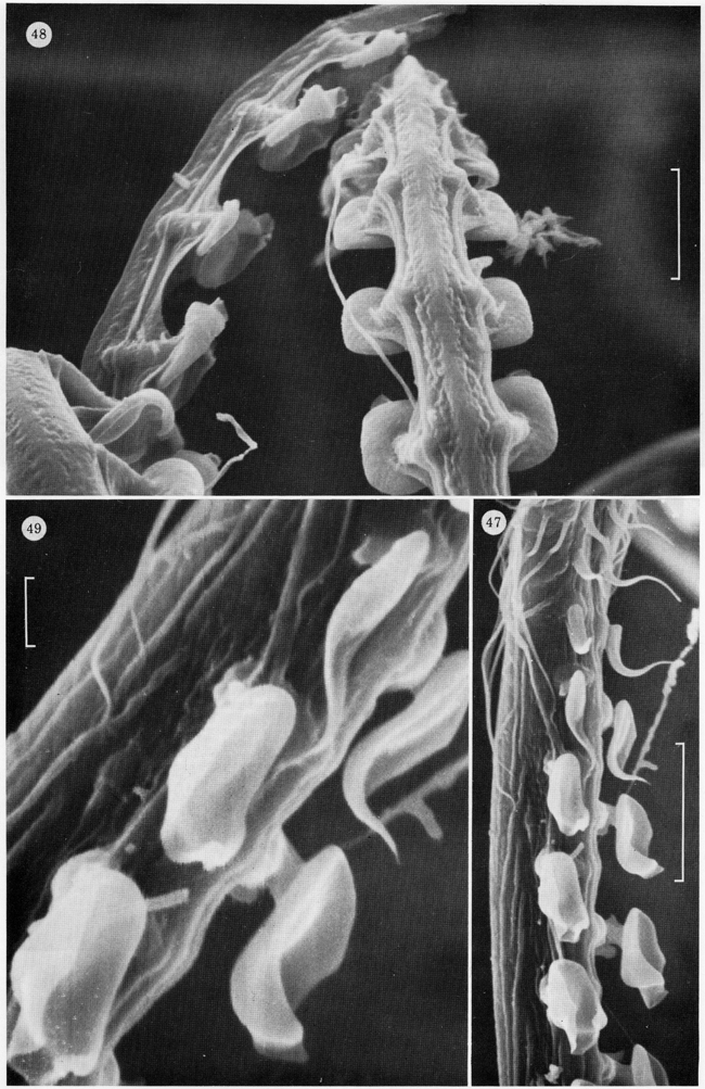 Espce Centraugaptilus horridus - Planche 5 de figures morphologiques