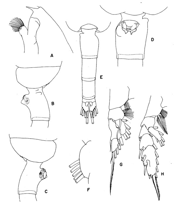 Espce Euchaeta acuta - Planche 1 de figures morphologiques