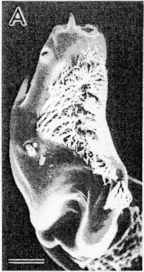 Espce Calanus sinicus - Planche 15 de figures morphologiques