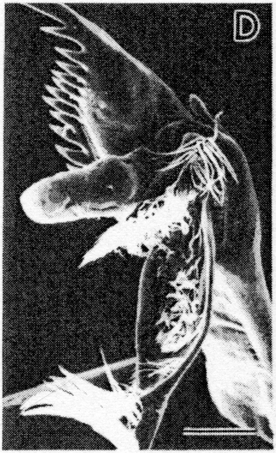 Espce Paraeuchaeta tuberculata - Planche 5 de figures morphologiques