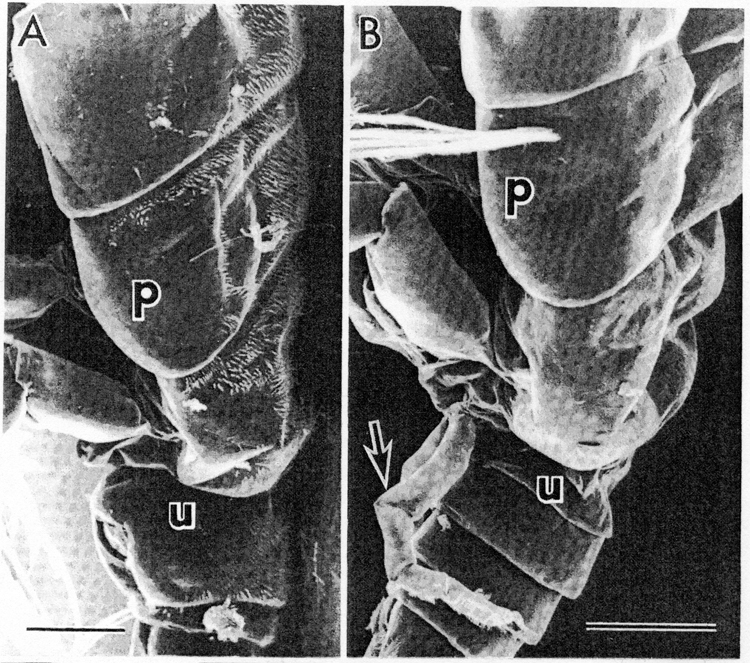Espèce Pareucalanus attenuatus - Planche 10 de figures morphologiques