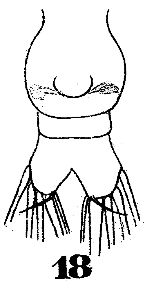 Espèce Subeucalanus subtenuis - Planche 5 de figures morphologiques