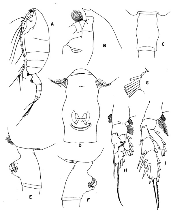 Espèce Paraeuchaeta tumidula - Planche 2 de figures morphologiques