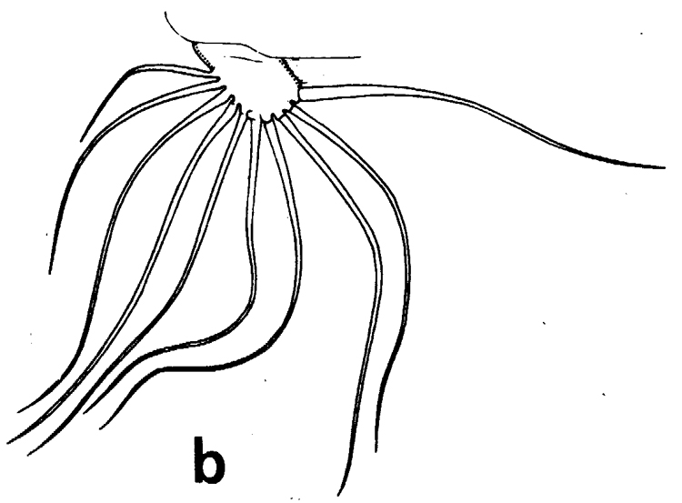 Espce Euchirella rostrata - Planche 11 de figures morphologiques
