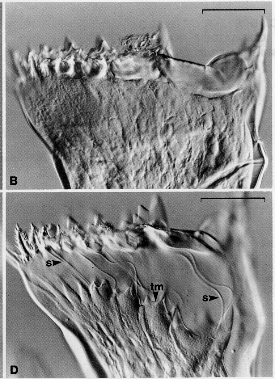 Espce Neocalanus cristatus - Planche 4 de figures morphologiques