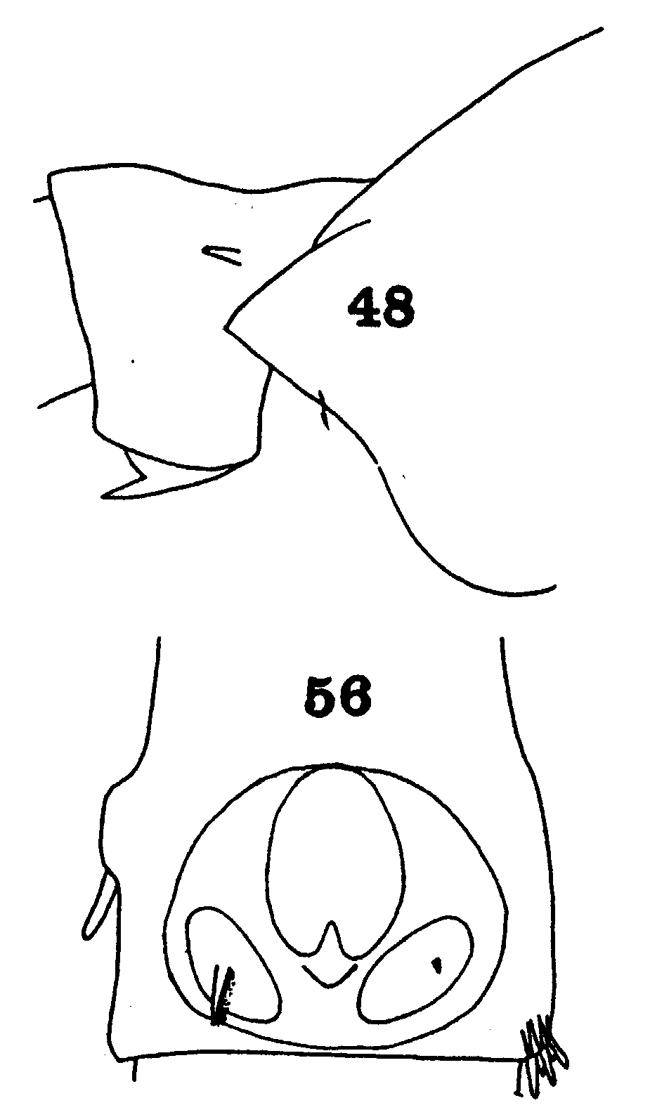 Espèce Undeuchaeta intermedia - Planche 7 de figures morphologiques