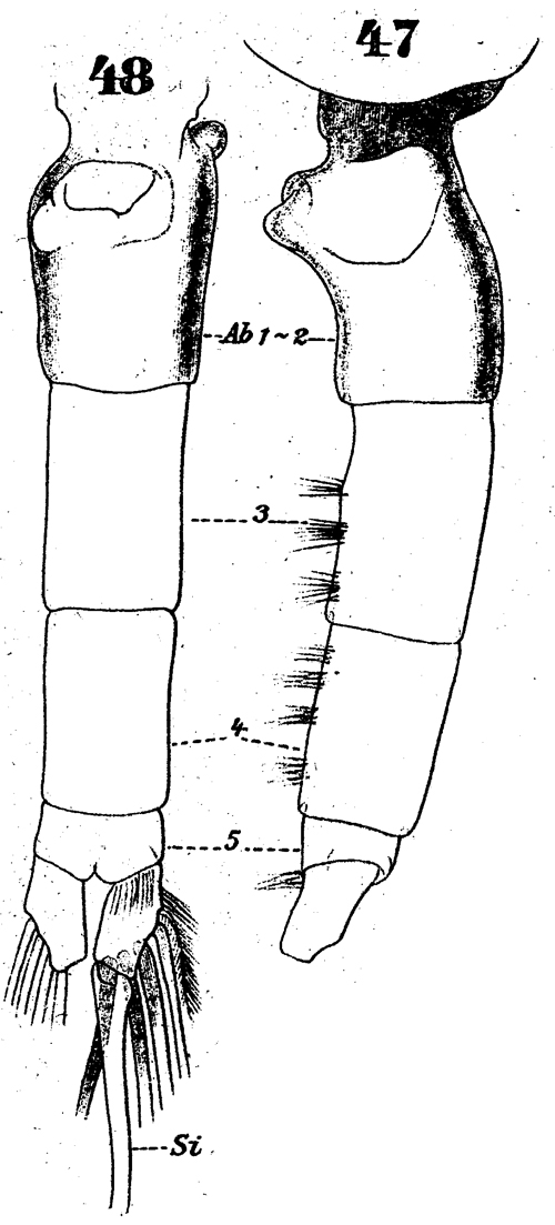 Espèce Euchaeta acuta - Planche 13 de figures morphologiques