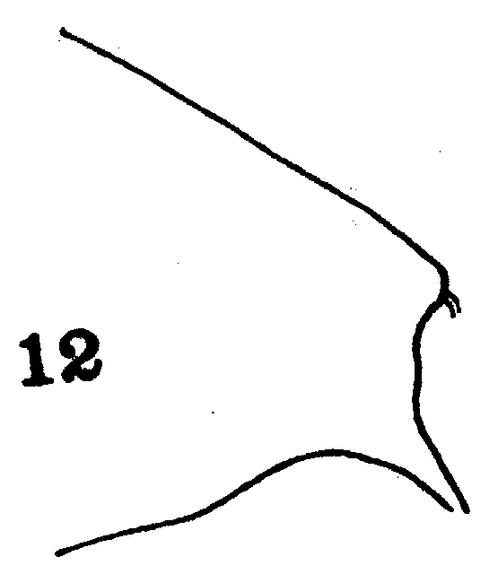 Espce Euchaeta tenuis - Planche 9 de figures morphologiques