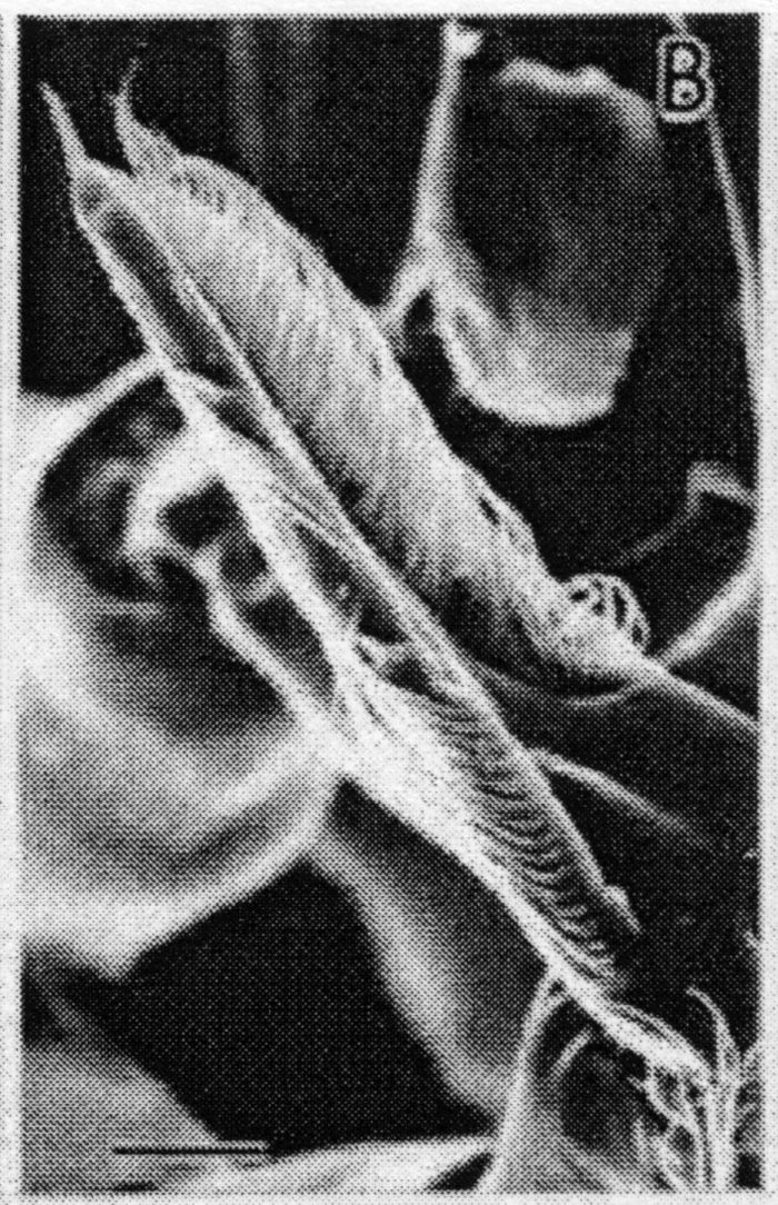 Espèce Candacia bipinnata - Planche 10 de figures morphologiques