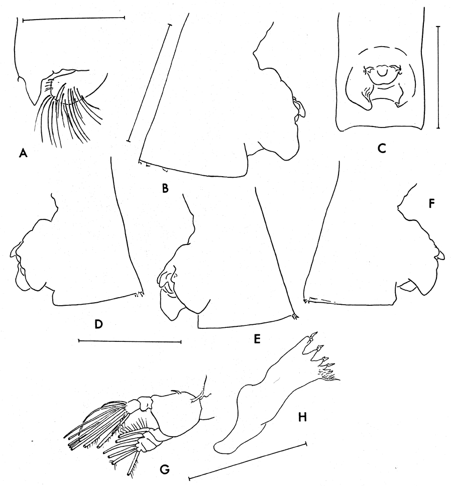 Espce Paraeuchaeta austrina - Planche 4 de figures morphologiques