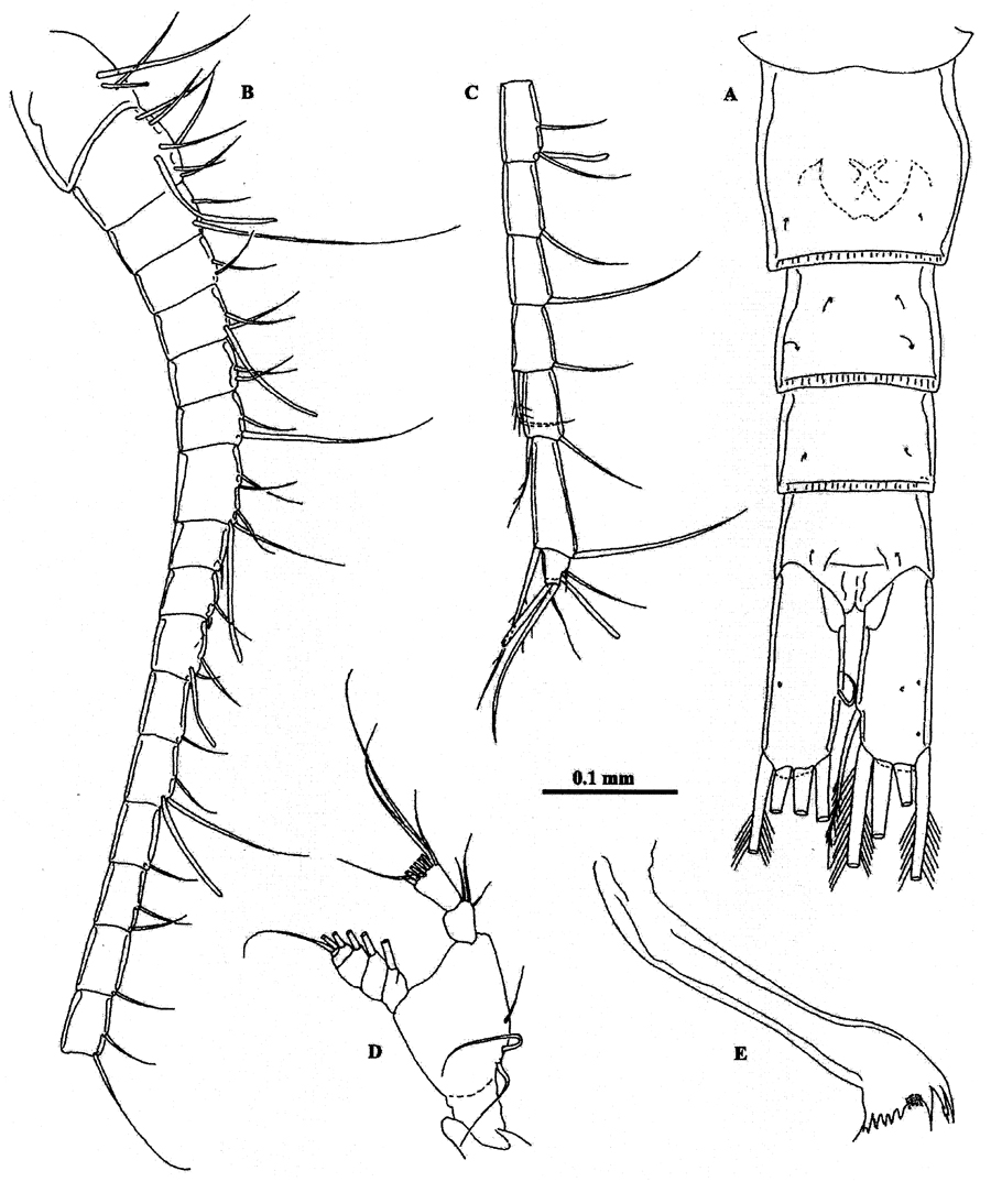 Espce Methanocalanus gabonicus - Planche 3 de figures morphologiques