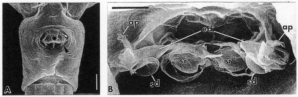 Espèce Acartia (Acanthacartia) bifilosa - Planche 7 de figures morphologiques