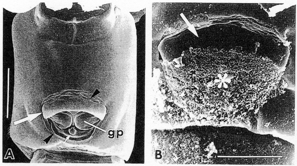 Espèce Acartiella keralensis - Planche 3 de figures morphologiques