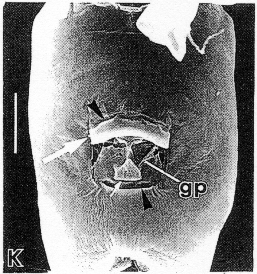 Espce Acartiella sewelli - Planche 2 de figures morphologiques