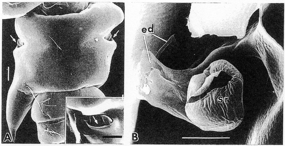 Espèce Pteriacartia josephinae - Planche 2 de figures morphologiques