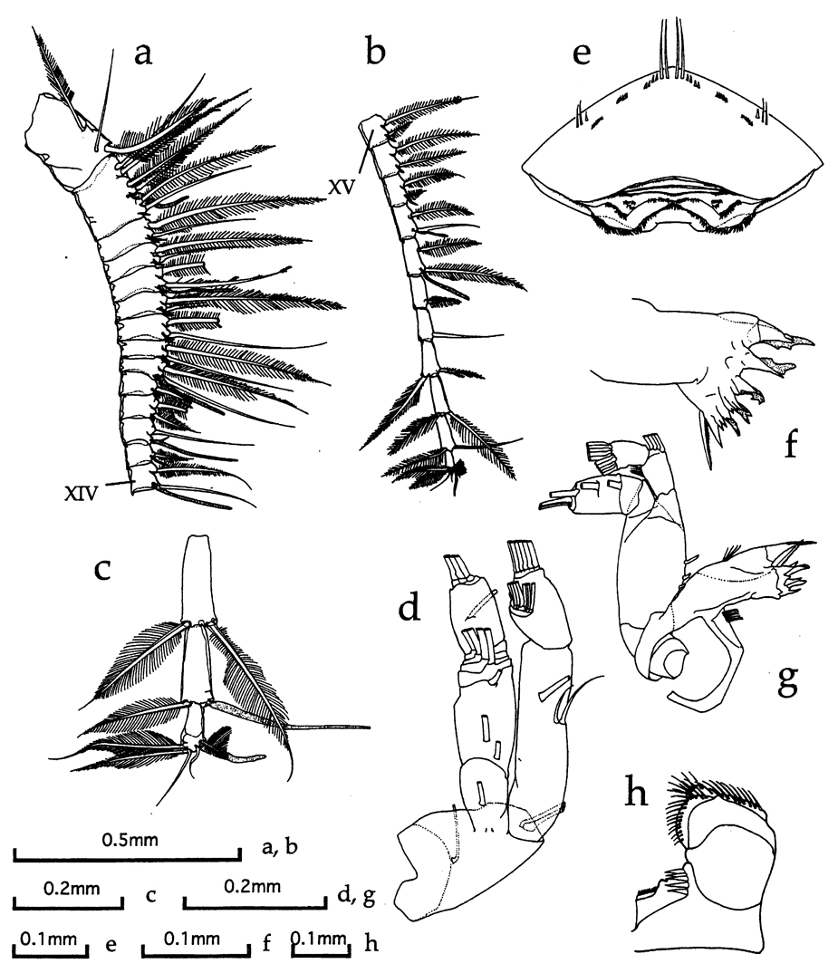 Espèce Ryocalanus spinifrons - Planche 2 de figures morphologiques