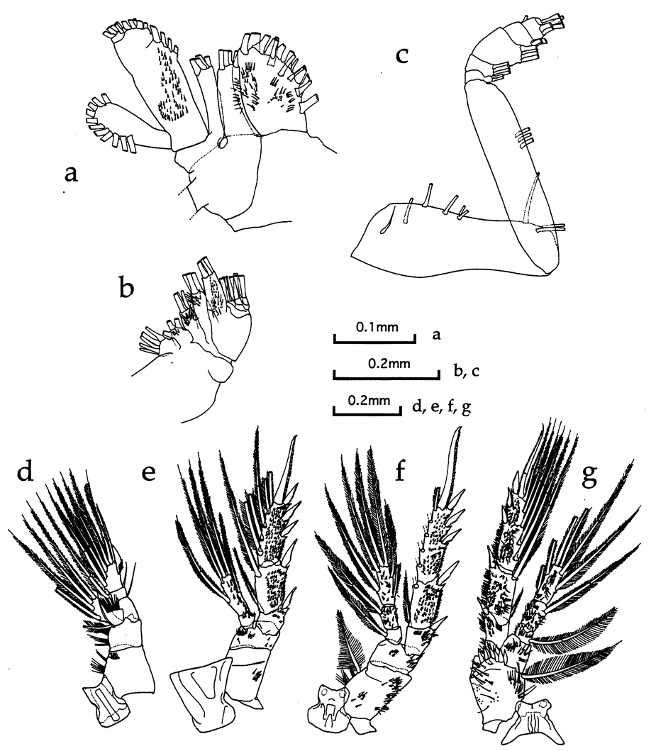 Espèce Ryocalanus spinifrons - Planche 3 de figures morphologiques