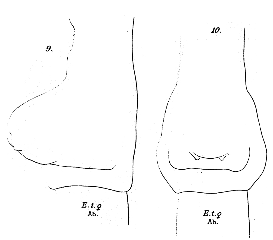 Espce Paraeuchaeta tonsa - Planche 20 de figures morphologiques