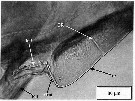 Espèce Chiridius gracilis - Planche 12 de figures morphologiques