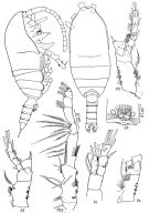 Espèce Spinocalanus horridus - Planche 1 de figures morphologiques