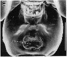 Species Labidocera wollastoni - Plate 21 of morphological figures