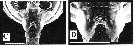 Species Pseudodiaptomus annandalei - Plate 5 of morphological figures