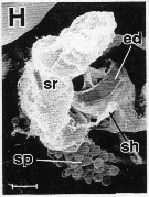 Espèce Neocalanus gracilis - Planche 18 de figures morphologiques