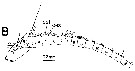 Espèce Neocalanus plumchrus - Planche 27 de figures morphologiques
