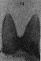 Espèce Lophothrix humilifrons - Planche 7 de figures morphologiques