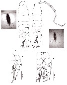 Espèce Centropages furcatus - Planche 18 de figures morphologiques