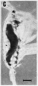 Espèce Acartia (Acartiura) clausi - Planche 47 de figures morphologiques