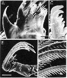 Espèce Tortanus (Boreotortanus) discaudatus - Planche 11 de figures morphologiques