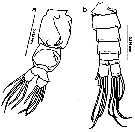 Espèce Labidocera minuta - Planche 22 de figures morphologiques